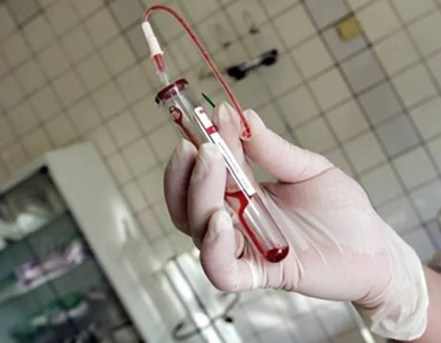 Foto «HIV/SIDA, o problemă a comunităţii»
