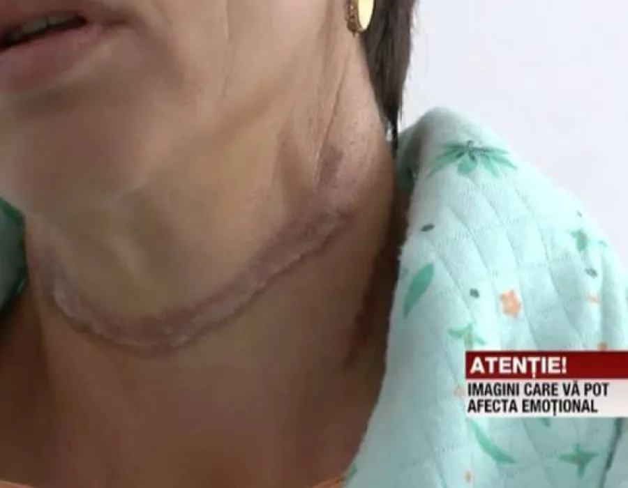 Foto INCREDIBIL: A încercat să se SPÂNZURE de caloriferul din baie