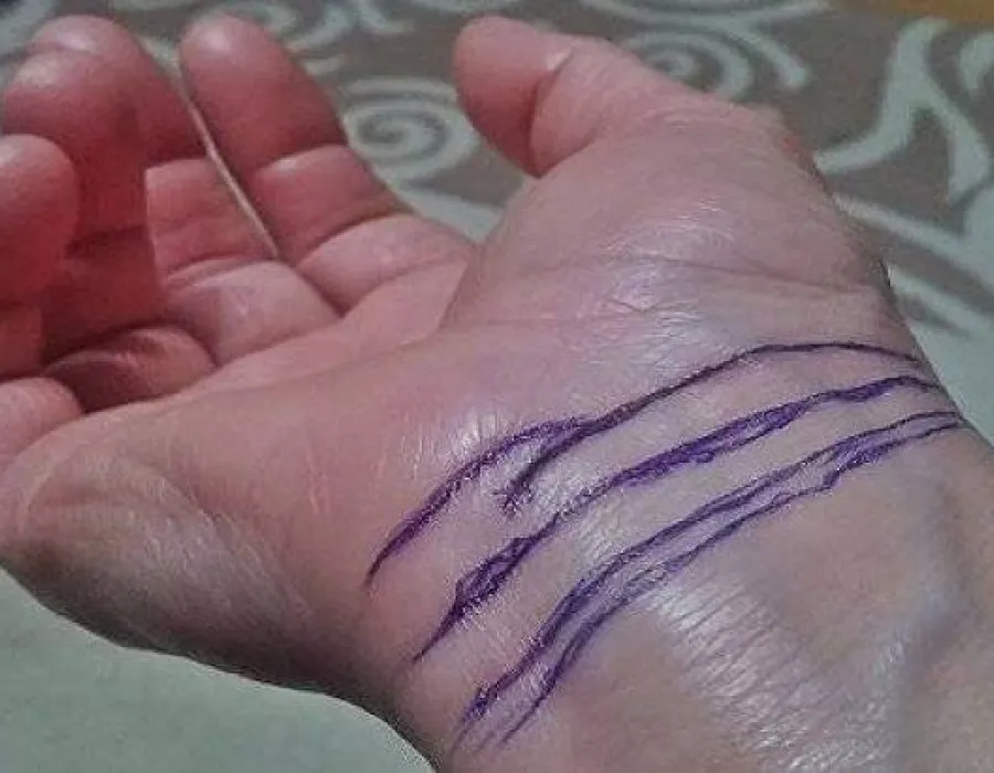 Foto Câte linii formate în piele ai la încheietura mâinii? Numărul lor îți spune câți ani vei trăi