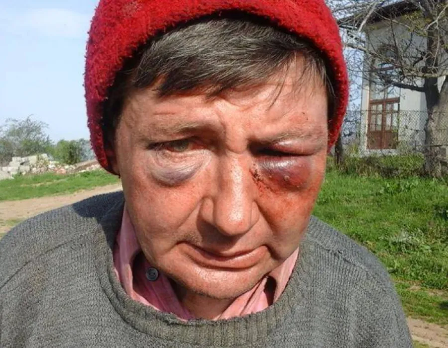 Foto Profesor din Mehedinţi bătut crunt de persoane necunoscute!