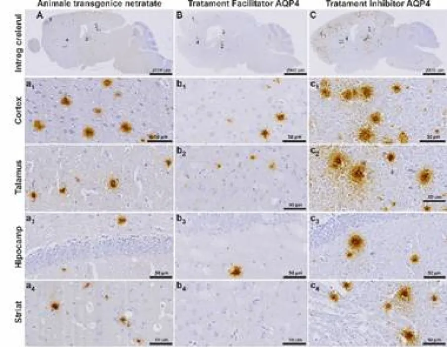 Foto Descoperire importantă la UMF Craiova: O proteină-cheie ar putea deschide noi tratamente pentru Alzheimer