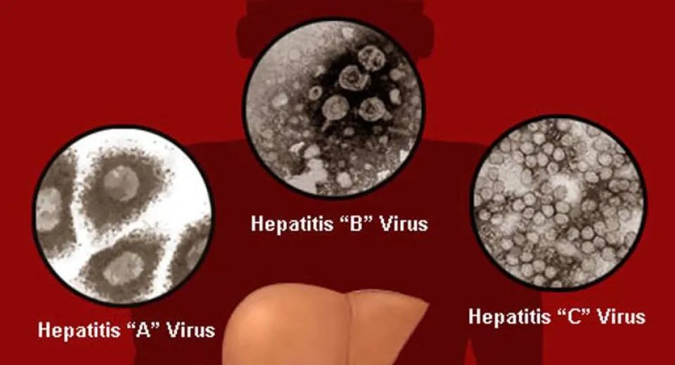 Foto Ziua Mondială de Luptă împotriva Hepatitei