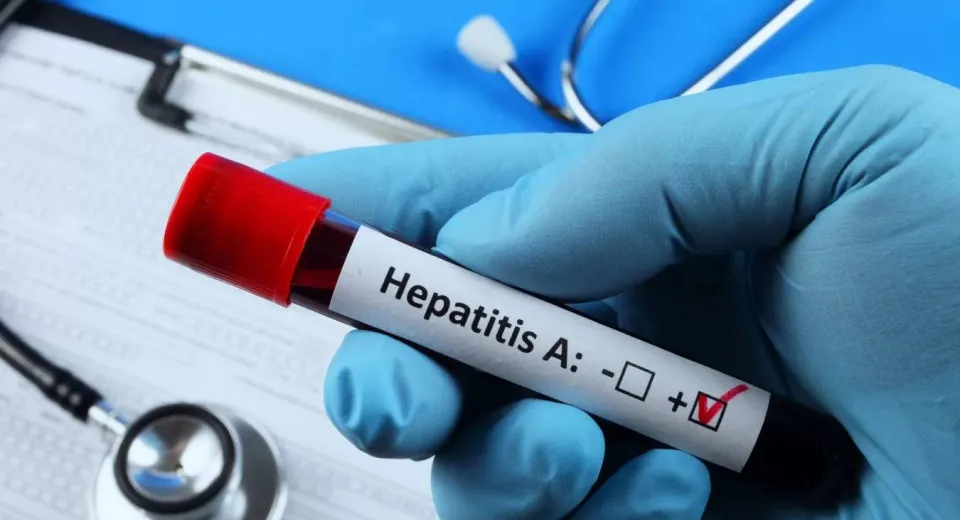 Foto Șapte focare de hepatită A în Dolj