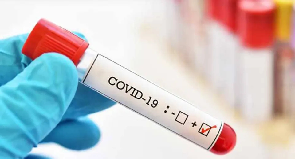 Foto Muncitori români angajați la o fermă din Germania, depistați cu coronavirus